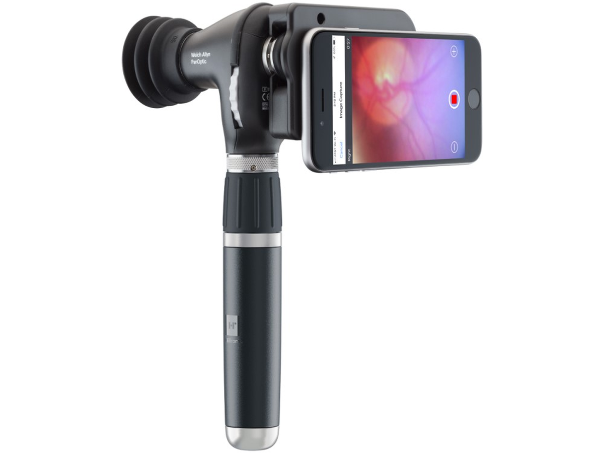 Welch Allyn PanOptic Plus Ophthalmoscope: Advanced Service and Optical System Guide